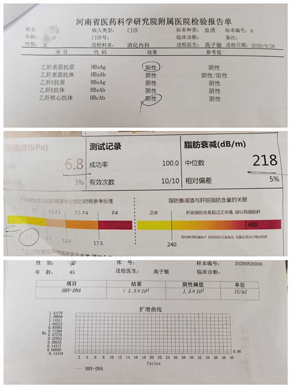 郑州治疗乙肝哪家医院好